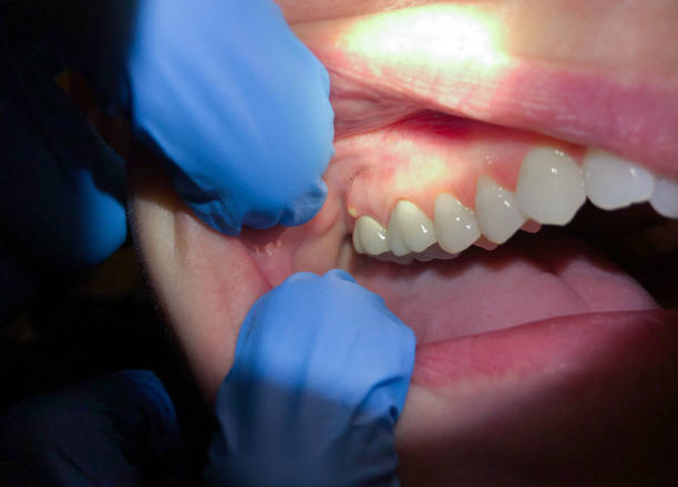 Best Broken Tooth Emergency  in Bethlehem, NC